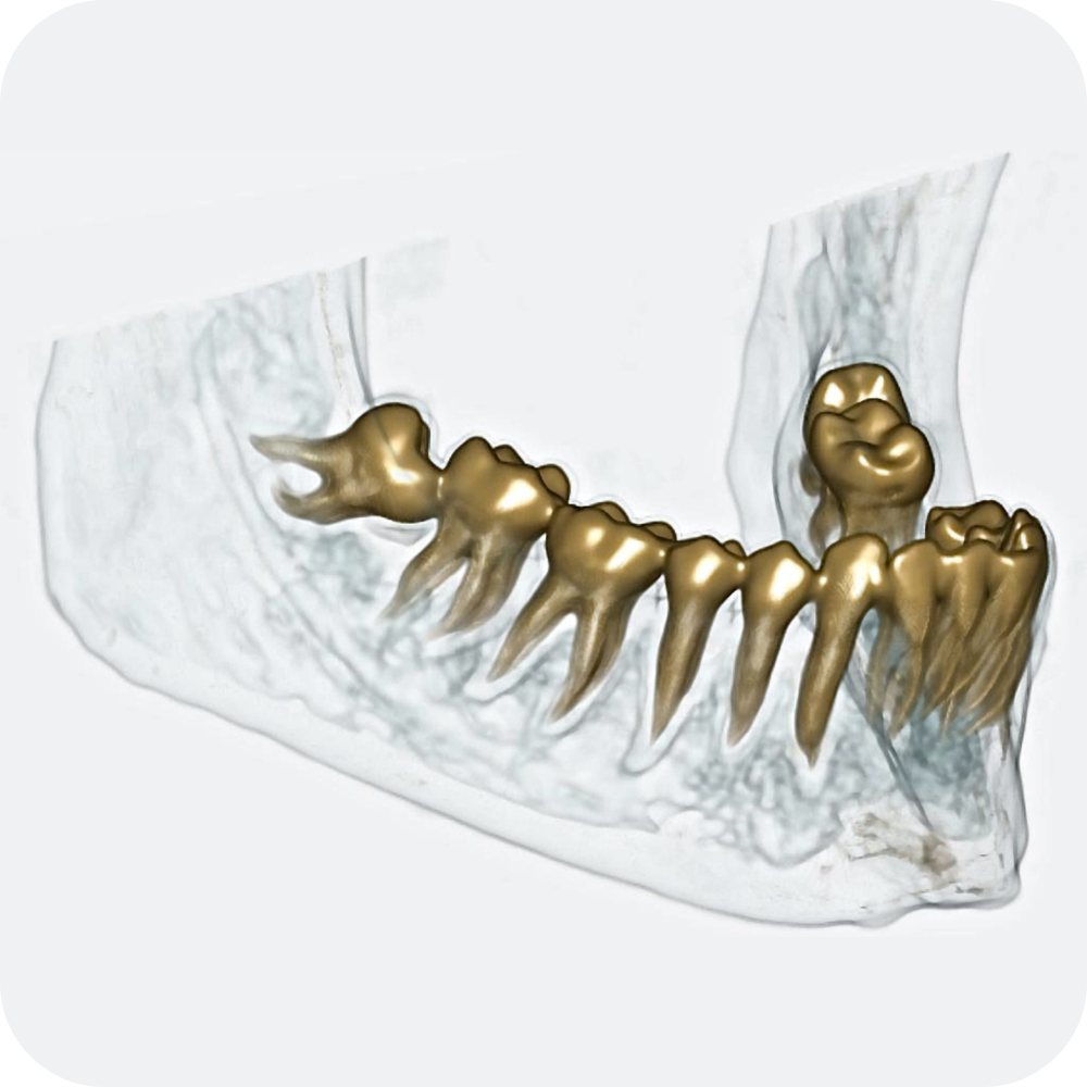 dentalscan