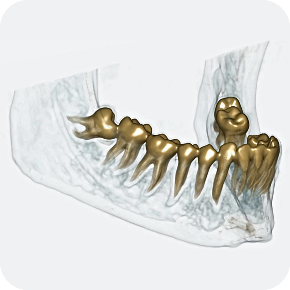 Dentalscan