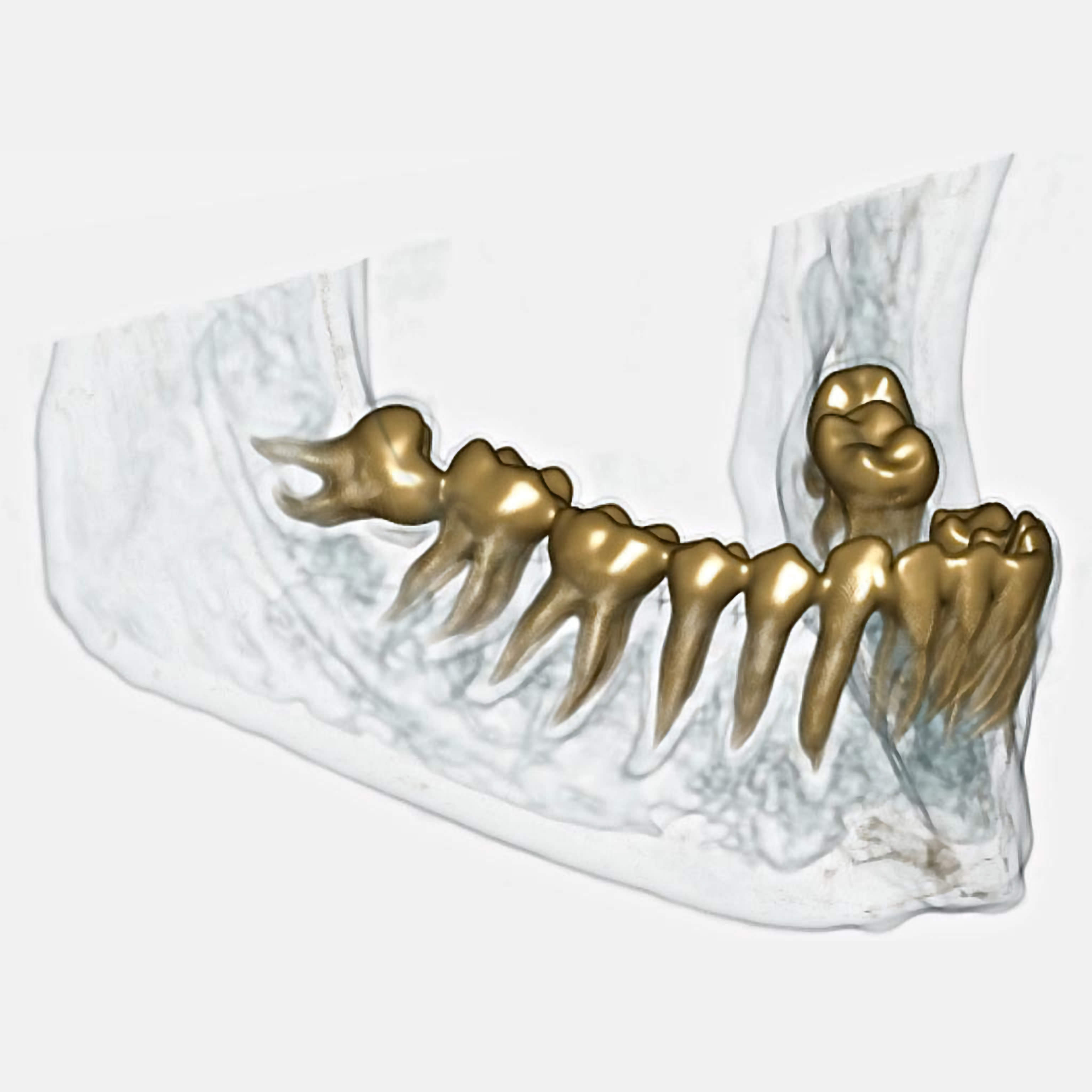 dentalscan