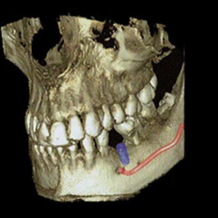 dentalscan