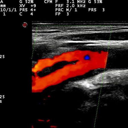 Radiodiagnostica Digitale
